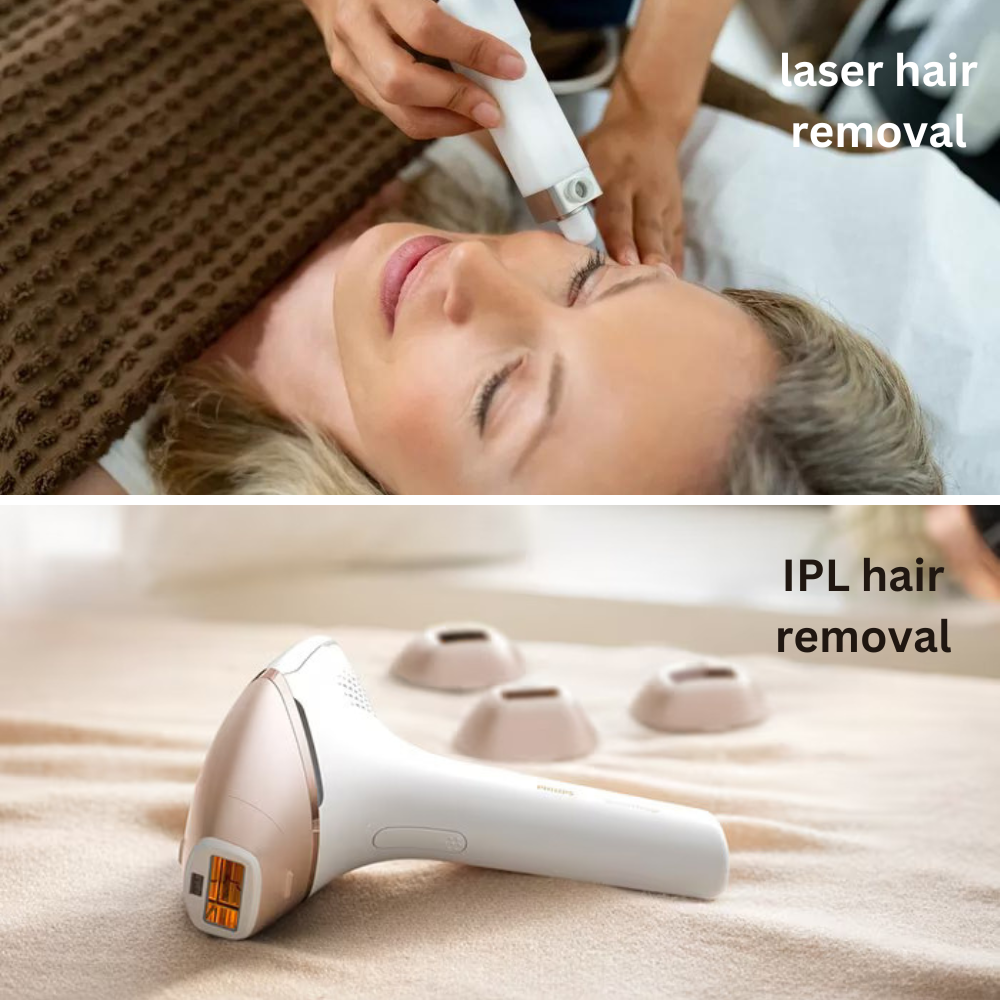 Difference between IPL and laser hair removal